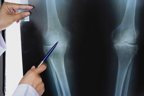 Medical_Knie_Operation_Doc_1920px